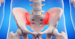 Sacroiliac-Joint